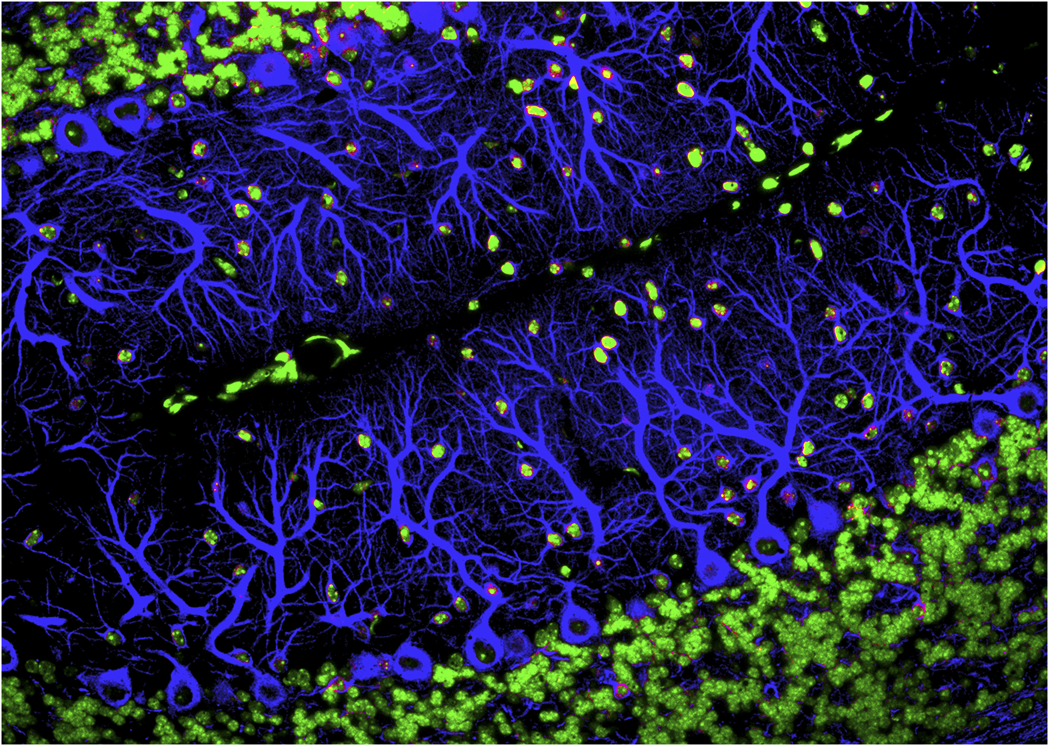 Brain image
